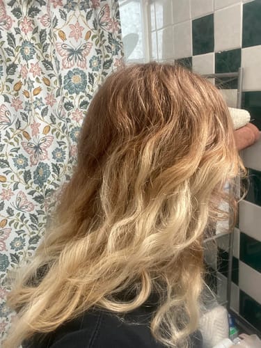 Yoracare review photo