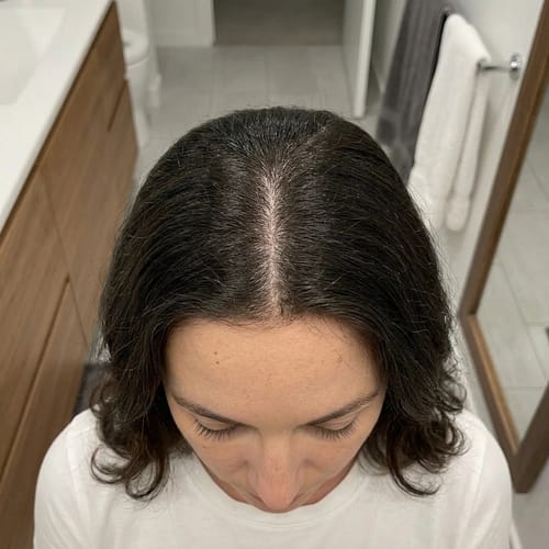 Yoracare review photo